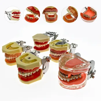Стоматологично изследване Моделируйте болестно пародонтоза при възрастни за обучение стоматология